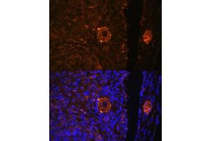 Immunofluorescence analysis of rat oophoroma cells using ZP3 antibody (ABIN6130818, ABIN6150537, ABIN6150539 and ABIN6224382) at dilution of 1:100.