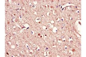 Immunohistochemistry of paraffin-embedded human brain tissue using ABIN7167318 at dilution of 1:100 (RAB39B anticorps  (AA 1-213))