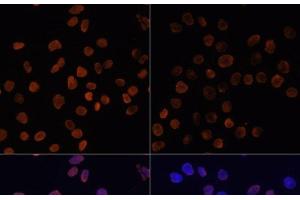 Immunofluorescence analysis of HeLa cells using Acetyl-Histone H2A-K5 Polyclonal Antibody at dilution of 1:100. (Histone H2A anticorps  (acLys5))