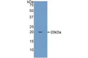 Detection of Recombinant PIN1, Human using Polyclonal Antibody to Peptidyl Prolyl Cis/Trans Isomerase NIMA Interacting Protein 1 (PIN1) (PIN1 anticorps  (AA 2-163))