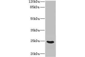 Western blot All lanes: FGF19 antibody IgG at 3. (FGF19 anticorps  (AA 25-216))