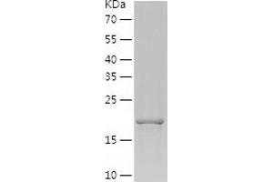 Western Blotting (WB) image for Amelogenin, X-Linked (AMELX) (AA 17-191) protein (His-IF2DI Tag) (ABIN7121805)