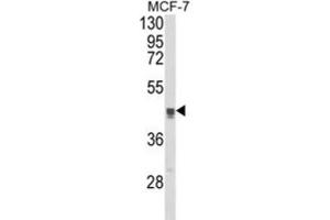 Western Blotting (WB) image for anti-Trans-Golgi Network Protein 2 (TGOLN2) antibody (ABIN3003981) (TGOLN2 anticorps)