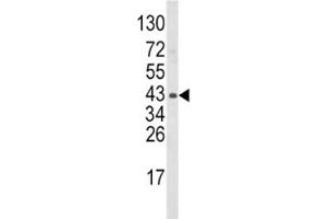 Western blot analysis of WNT5B antibody and mouse bladder tissue lysate.