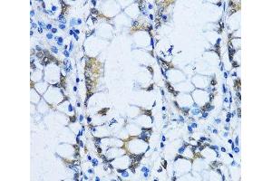 Immunohistochemistry of paraffin-embedded Human stomach using VIL1 Polyclonal Antibody at dilution of 1:100 (40x lens). (Villin 1 anticorps)