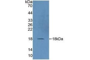 Detection of Recombinant DUSP5, Human using Polyclonal Antibody to Dual Specificity Phosphatase 5 (DUSP5) (DUSP5 anticorps  (AA 1-135))