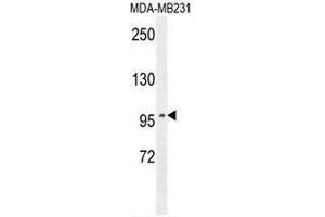 ST7 Antibody (Center) western blot analysis in MDA-MB231 cell line lysates (35µg/lane). (ST7 anticorps  (Middle Region))