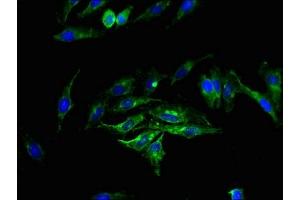 Immunofluorescence staining of Hela cells with ABIN7163135 at 1:200, counter-stained with DAPI. (Sphingomyelin Synthase 2 anticorps  (AA 1-79))