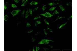 Immunofluorescence of purified MaxPab antibody to OXA1L on HeLa cell. (OXA1L anticorps  (AA 1-435))