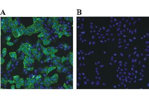 Immunofluorescence (IF) image for Rabbit anti-Chicken IgY antibody (DyLight 488) (ABIN1450234) (Lapin anti-Poulet IgY Anticorps (DyLight 488))