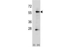 Western blot analysis of placental Alkaline Phosphatase antibody and 293 cell lysate (2 ug/lane) either nontransfected (Lane 1) or transiently transfected (2) with the ALPP gene.