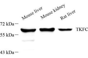 Western blot analysis of DAK (ABIN7073737),at dilution of 1: 1000,Lane 1: Mouse liver tissue lysate,Lane 2: Mouse kidney tissue lysate,Lane 3: Rat liver tissue lysate (DAK anticorps)