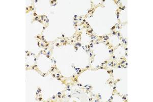 Immunohistochemistry of paraffin-embedded rat lung using SUZ12 antibody (ABIN5975314) at dilution of 1/100 (40x lens). (SUZ12 anticorps)