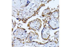 Immunohistochemistry of paraffin-embedded human placenta using RPS27A antibody (ABIN3022728, ABIN3022729, ABIN1513489, ABIN1514633 and ABIN6219198) at dilution of 1:100 (40x lens). (RPS27A anticorps  (AA 1-156))