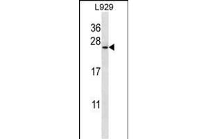COPZ1 Antibody (N-term) (ABIN657051 and ABIN2846218) western blot analysis in  cell line lysates (35 μg/lane).
