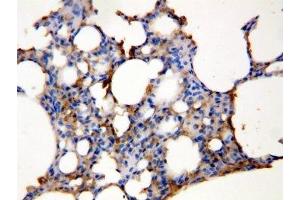 IHC-P: Aquaporin 5 antibody testing of rat lung tissue lysate (Aquaporin 5 anticorps  (C-Term))