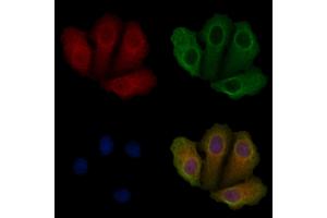 ABIN6259201 and ABIN6275855 staining Hela cells by IF/ICC.