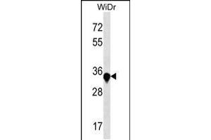 Western blot analysis in WiDr cell line lysates (35ug/lane). (AMMECR1 anticorps  (C-Term))