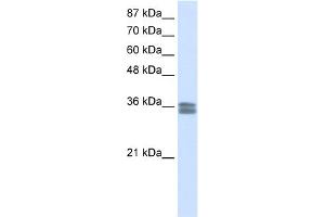 WB Suggested Anti-CACNG4 Antibody Titration:  0.