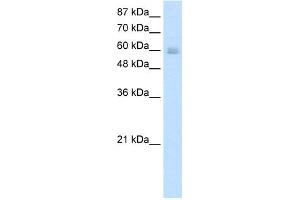 WB Suggested Anti-NKX6-3 Antibody Titration:  5. (NK6 Homeobox 3 anticorps  (N-Term))
