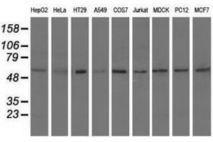 Image no. 4 for anti-Syntrophin, alpha 1 (Dystrophin-Associated Protein A1, 59kDa, Acidic Component) (SNTA1) antibody (ABIN1501028)