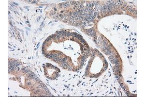 Immunohistochemical staining of paraffin-embedded Human thyroid tissue using anti-USP5 mouse monoclonal antibody. (USP5 anticorps)