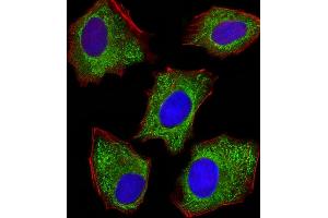 Fluorescent image of HepG2 cells stained with XAF1 PDIA6 Antibody (Center ) (ABIN390608 and ABIN2840920).
