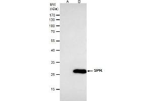IP Image SPR antibody [N2C3] immunoprecipitates SPR protein in IP experiments. (SPR anticorps)