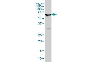 SMARCD2 monoclonal antibody (M01), clone 2F7 Western Blot analysis of SMARCD2 expression in Hela S3 NE .