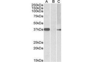 HEK293 lysate (10µg protein in RIPA buffer) overexpressing Human MYF6 with MYC tag probed with AP21502PU-N (0. (MYF6 anticorps  (Internal Region))