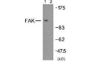 Western blot analysis of extracts from HeLa cells using FAK (Ab-925) antibody (#B7083). (FAK anticorps  (Tyr925))