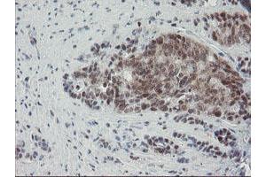 Image no. 2 for anti-Negative Regulator of Ubiquitin-Like Proteins 1 (NUB1) (AA 1-326) antibody (ABIN1490743)