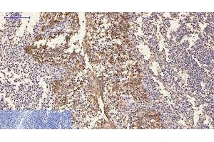 Immunohistochemistry of paraffin-embedded Human tonsil tissue using CK-16 Monoclonal Antibody at dilution of 1:200.