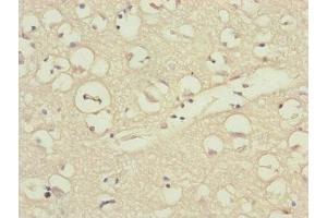 Immunohistochemistry of paraffin-embedded human brain tissue using ABIN7157675 at dilution of 1:100 (DSN1 anticorps  (AA 1-356))