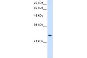 Western Blotting (WB) image for anti-phosphopantothenoylcysteine Decarboxylase (PPCDC) antibody (ABIN2462970) (PPCDC anticorps)