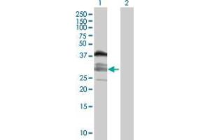Lane 1: C10orf81 transfected lysate ( 31.