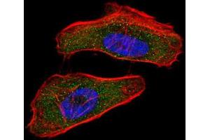 Immunofluorescence (IF) image for anti-Hypoxia Inducible Factor 1, alpha Subunit (Basic Helix-Loop-Helix Transcription Factor) (HIF1A) antibody (ABIN3002131)