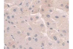IHC-P analysis of Human Liver Tissue, with DAB staining. (HFE2 anticorps  (AA 234-416))