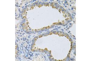Immunohistochemistry of paraffin-embedded mouse lung using AP2B1 Antibody. (AP2B1 anticorps  (AA 752-951))