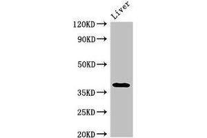 Western Blot Positive WB detected in: Rat liver tissue All lanes: PRKAG1 antibody at 3 μg/mL Secondary Goat polyclonal to rabbit IgG at 1/50000 dilution Predicted band size: 38, 35, 39 kDa Observed band size: 38 kDa (PRKAG1 anticorps  (AA 1-331))