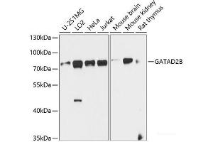 Western blot analysis of extracts of various cell lines using GATAD2B Polyclonal Antibody at dilution of 1:1000. (GATAD2B anticorps)