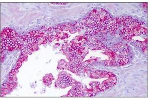 Human Prostate, Epithelium: Formalin-Fixed, Paraffin-Embedded (FFPE)