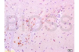 Immunohistochemistry (IHC) image for anti-Glial Cell Line Derived Neurotrophic Factor (GDNF) (AA 121-211) antibody (ABIN736536)