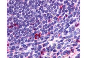 Anti-CCR2 antibody IHC of human spleen, lymphocytes.