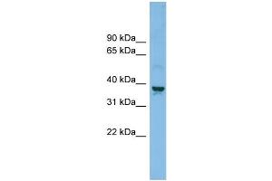 WB Suggested Anti-SLC30A3 Antibody Titration: 0. (Slc30a3 anticorps  (Middle Region))