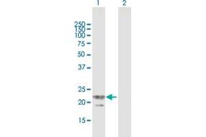 Western Blot analysis of TRGV3 expression in transfected 293T cell line by TRGV3 MaxPab polyclonal antibody. (TRGV3 anticorps  (AA 1-200))