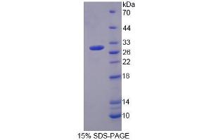 Image no. 1 for Membrane Protein, Palmitoylated 2 (MAGUK P55 Subfamily Member 2) (MPP2) (AA 345-573) protein (His tag) (ABIN6236682) (MPP2 Protein (AA 345-573) (His tag))