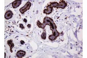 Image no. 6 for anti-Mucin 1 (MUC1) antibody (ABIN1499598)