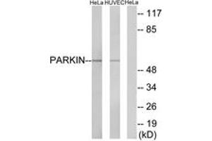 Western blot analysis of extracts from HeLa/HuvEc cells, using Parkin (Ab-131) Antibody. (Parkin anticorps  (AA 101-150))