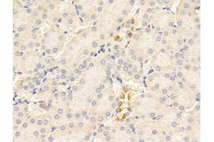 ABIN6265820 and ABIN6268771 at 1/100 staining Rat kidney tissue by IHC-P. (TYK2 anticorps  (C-Term))